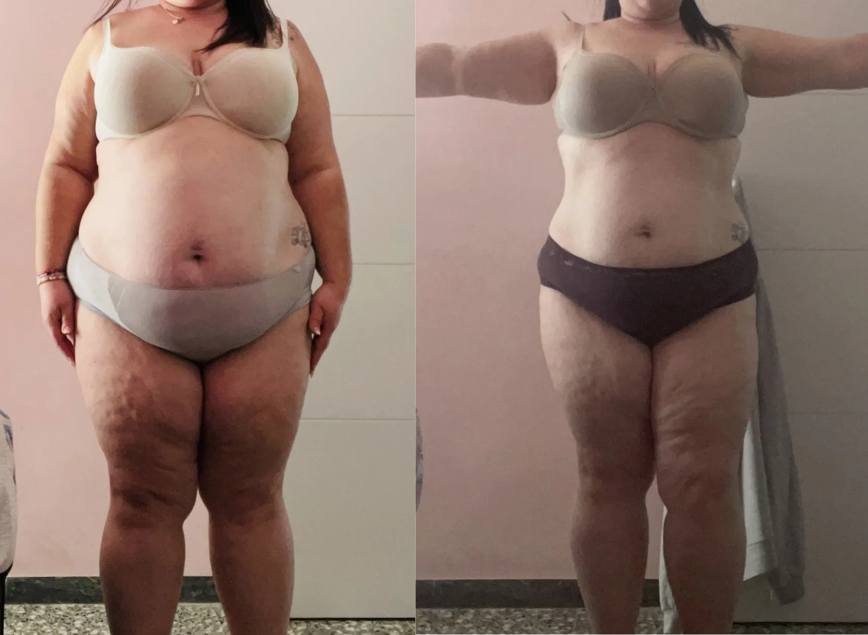 Evolución física de Esther vista de frente, antes y después
